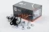 <strong>Опора кульова нижня BMW X5 (E53) 00-07 ABS 220351 (фото 1)</strong>