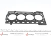 <strong>Комплект ущільнювачів (верхній) Skoda Octavia/Rapi ELRING 517.171 (фото 4)</strong>