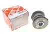 <strong>К-т втулок ресори FEBI BILSTEIN 101363 (фото 1)</strong>