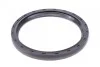<strong>Комплект ланцюга приводу розподільчого вала FEBI BILSTEIN 102040 (фото 11)</strong>