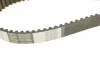 <strong>Комплект газорозподільчого механізму HEPU PK05450 (фото 3)</strong>