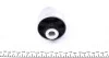 <strong>Сайлентблок важеля X3 F25 10- XDRIVE/SDRIVE PRZEDN MEYLE 3146100019 (фото 4)</strong>