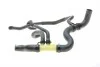 <strong>Патрубок радіатора Renault Master/Opel Movano 2.3dCi 10- (нижній) RENAULT 215039970R (фото 1)</strong>