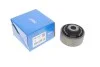 <strong>Сайлентблок важеля SKF VKDS 335006 (фото 2)</strong>