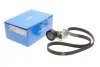 <strong>Роликовий модуль натягувача ременя (ролик, ремінь) SKF VKMA 36179 (фото 2)</strong>